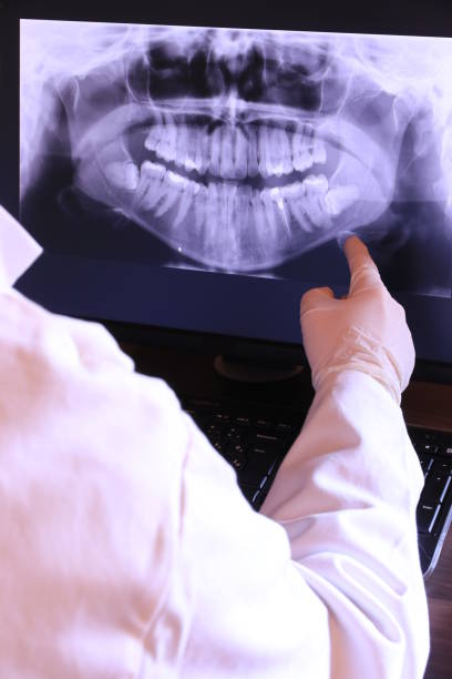 Best Emergency Dentist for Lost Fillings or Crowns in Friedens, PA